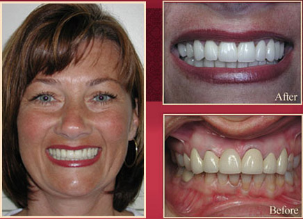 Red haired female patient before and after smile
