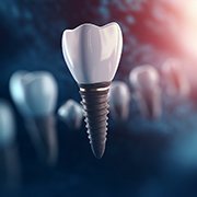 CGI dental implant levitating in front of several blurry implants in the background