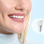 Nose-to-chin view of a woman with blond hair smiling with dental implant indicated