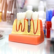 Model of dental implant in Los Alamitos, CA on desk