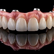 an example of implant dentures in Los Alamitos