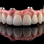 an example of implant dentures in Los Alamitos