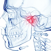 Illustration of TMD