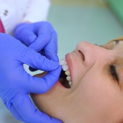 woman getting veneers in Los Alamitos 