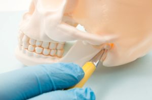 dentist pointing to model skull for TMJ in Los Alamitos.