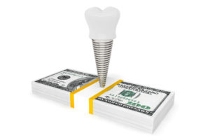 Tooth Implant With Money on a white background